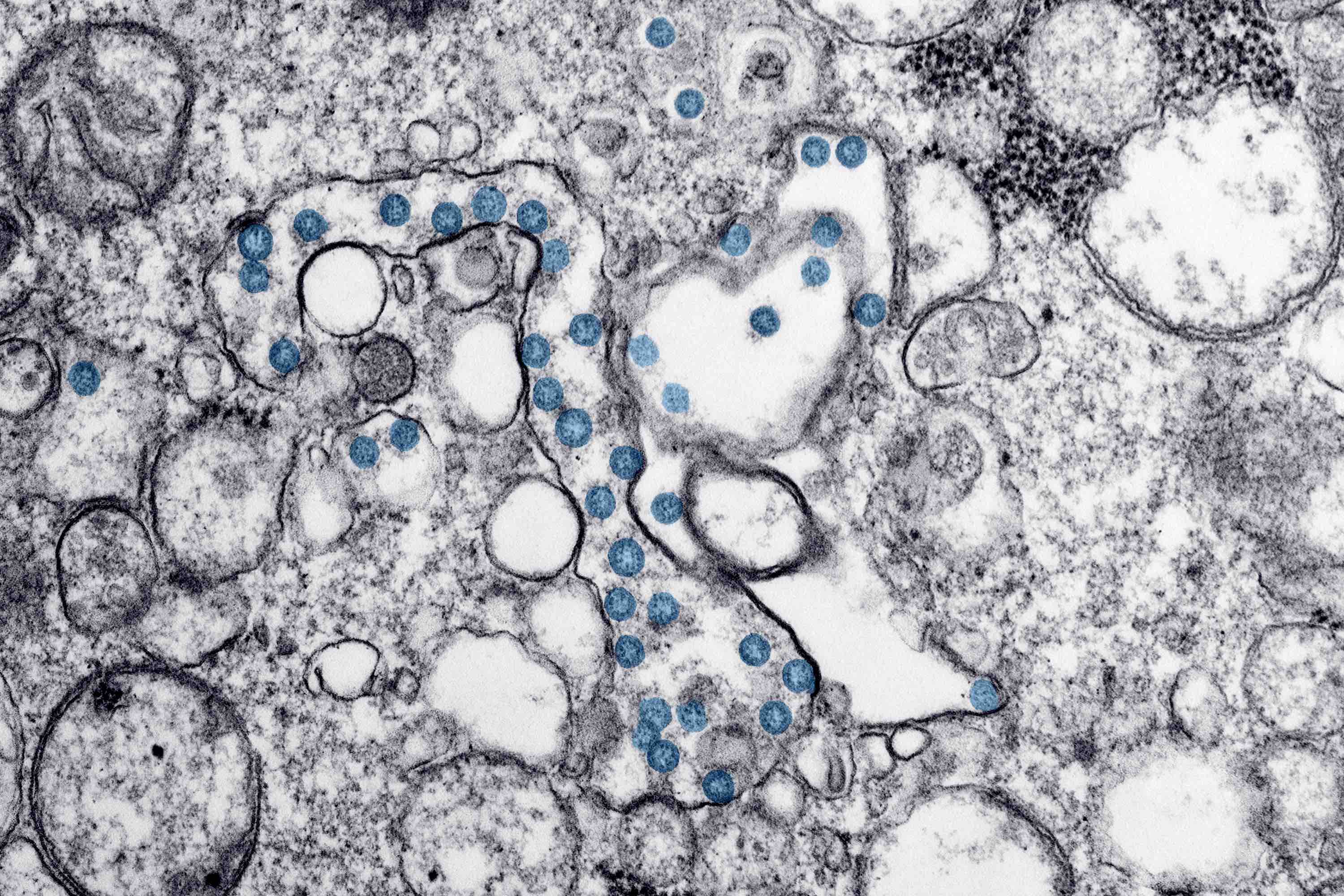 COVID-19 viral particles, journal of wild culture ©2020