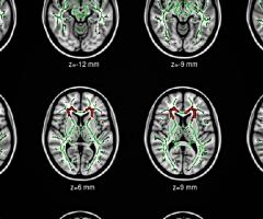 Brain scans, Journal of Wild Culture, ©2015